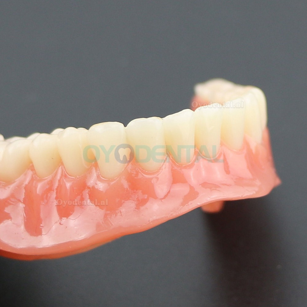 Demo-onderzoek tandheelkundige onderste tanden Model 6002 02 Overdenture Inferior 4 implantaten